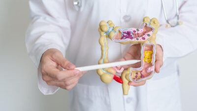 Kabızlık Neden Olur? Nasıl Geçer? Kabızlık Neden Olur? Nasıl Geçer? Kabızlık, sindirim sisteminin normalden daha
