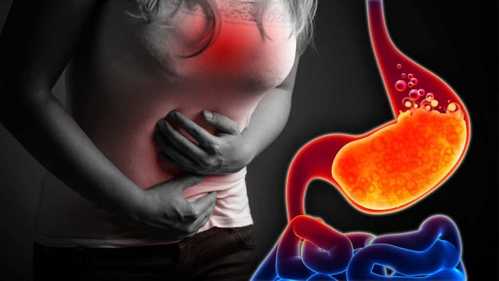 Reflüye Hangi Yiyecekler İyi Gelir? Reflü kişilerde sık görülen rahatsızlıklardan