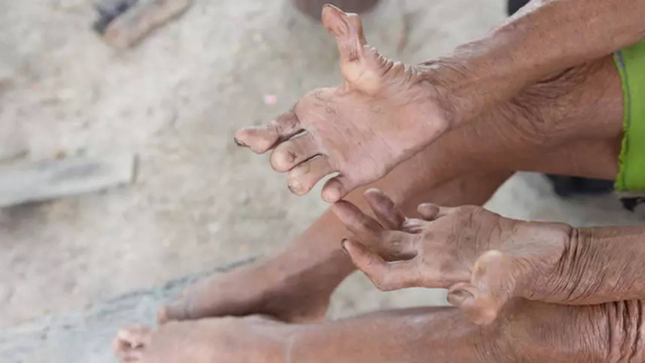 Avrupa kıtası, modern tıp ve sağlık altyapısının gelişmesiyle birçok bulaşıcı