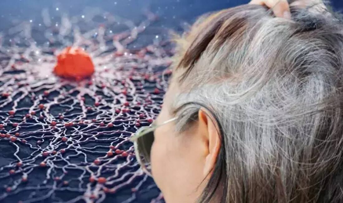 Beyaz Saç: Vücudun Kanserle Mücadele Alarmı Beyaz saçlar, çoğu insan için yaşlanmanın kaçınılmaz bir işareti olarak
