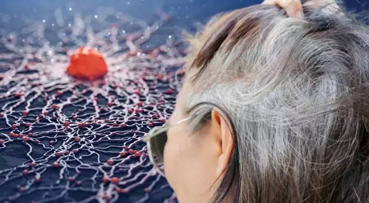 Beyaz saçlar, çoğu insan için yaşlanmanın kaçınılmaz bir işareti olarak