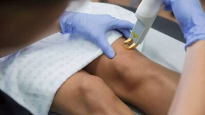 Varis kaynaklı bacak ağrıları, özellikle günün ilerleyen saatlerinde artarak kişilerin