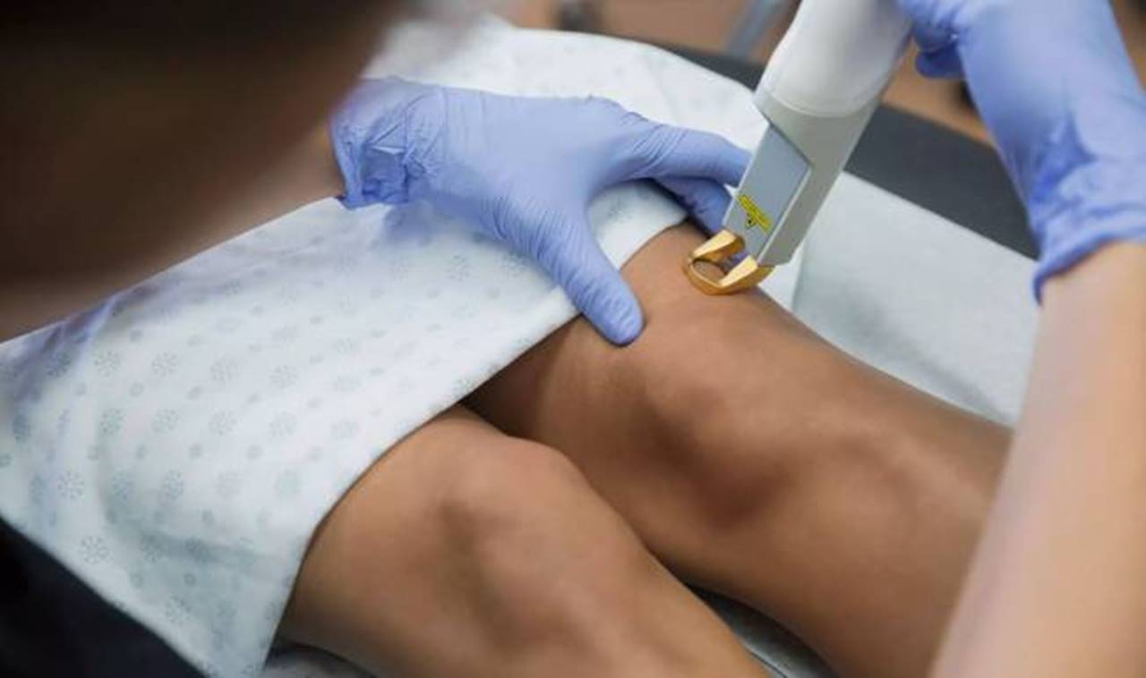 Varis kaynaklı bacak ağrıları, özellikle günün ilerleyen saatlerinde artarak kişilerin