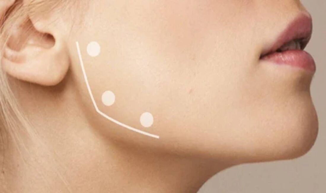 Diş Sıkmanın Kökünü Kazıyan İşte O Çözüm Son yıllarda hem estetik hem de fonksiyonel faydalarıyla öne çıkan