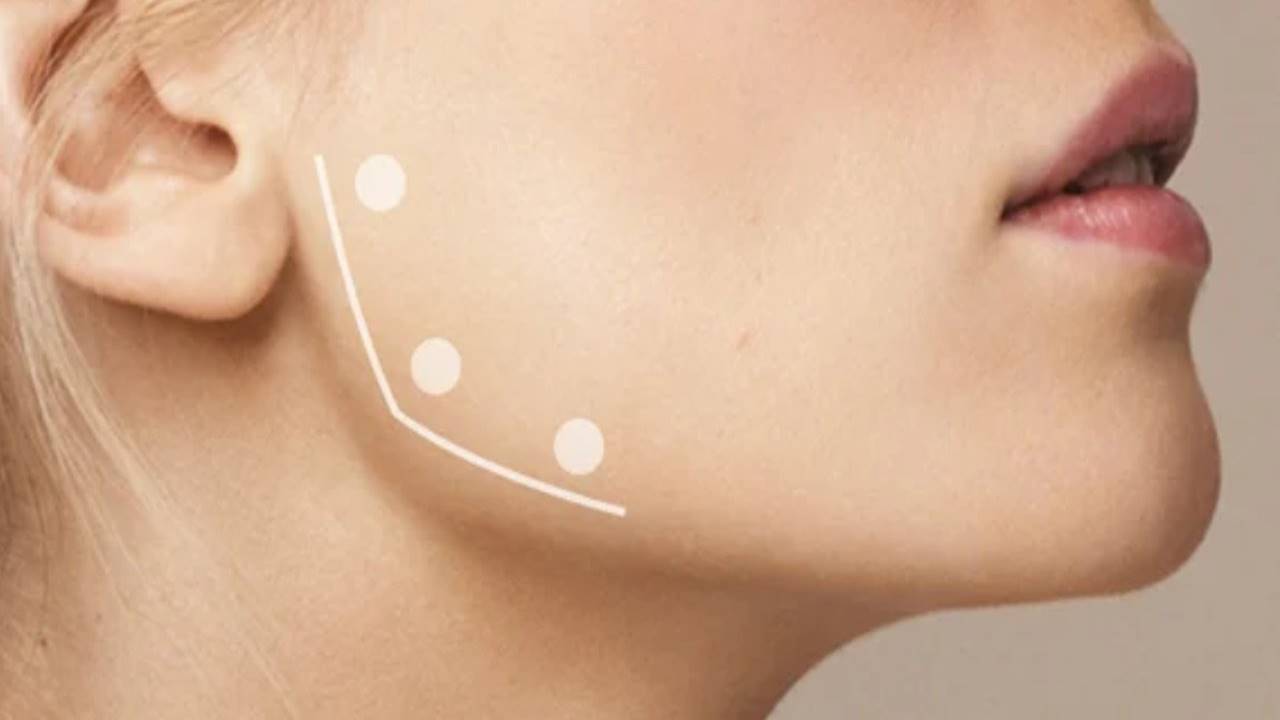 Son yıllarda hem estetik hem de fonksiyonel faydalarıyla öne çıkan