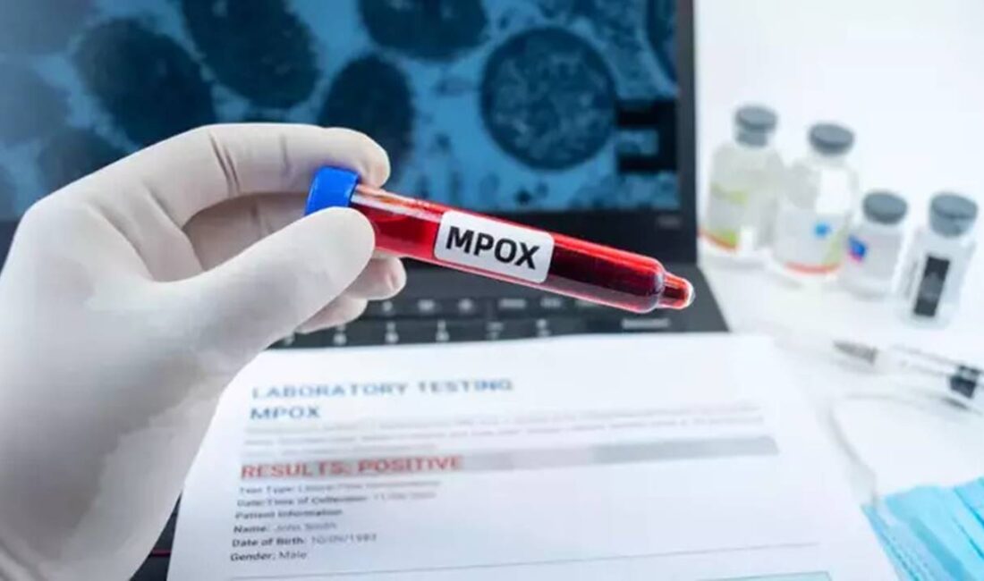 İngiltere’deki bilim insanları, daha önce “maymun çiçeği” olarak bilinen ve