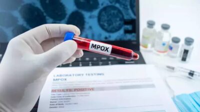 İngiltere’deki bilim insanları, daha önce “maymun çiçeği” olarak bilinen ve