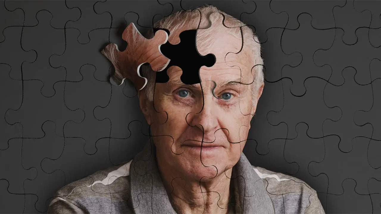 Alzheimer hastalığı, günümüz tıbbının çözülmesi en zor problemlerinden biri olmayı