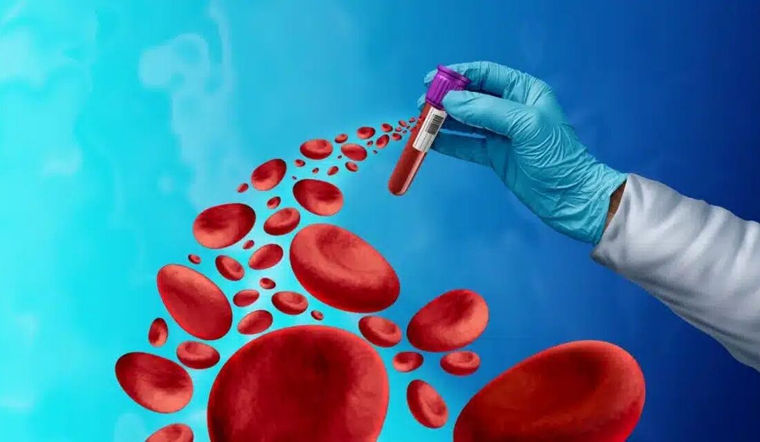 Uzmanlar Uyardı: Löseminin En Tehlikeli Belirtisi Sessiz İlerliyor Bilim dünyasında yapılan yeni bir araştırma, löseminin ortaya çıkış sürecine