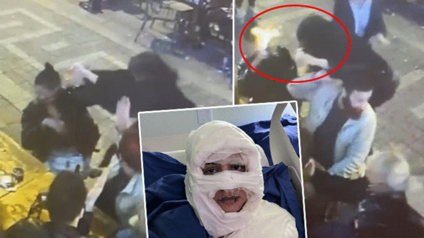 Kadıköy’de Gözde Yılmaz’a kolonya döküp ateşe veren Sibel Arya Geriş,