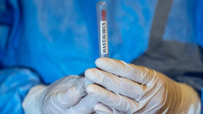 Dünya Sağlık Örgütü, MV Hondius yolcu gemisinde tespit edilen hantavirüs